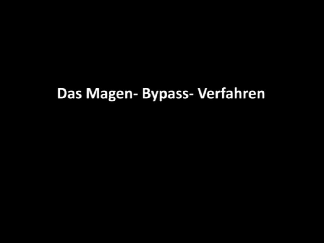 Video zum Magenbypass